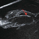 Image for article titled Here's an Anatomical Structure We've Never Seen in the Penis Before